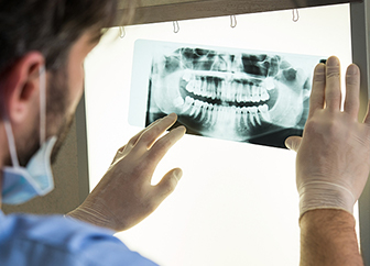 Dental X-rays