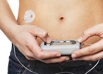 Insulin Pump Therapy