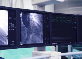 MRI and catheter angiography lab