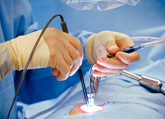 Non-invasive (laparoscopic) Surgeries