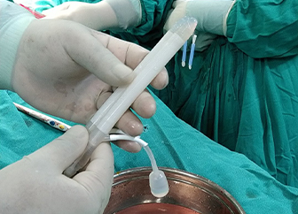 Penile Prosthesis