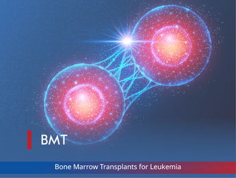 Bone Marrow Transplants for Leukemia