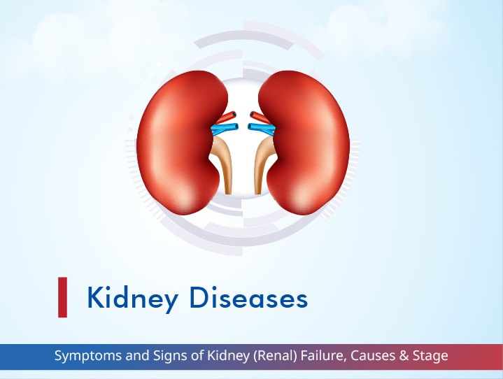 Symptoms and Signs of Kidney (Renal) Failure, Causes & Stages