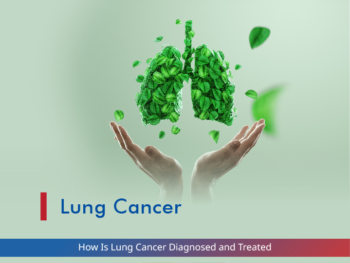 How Is Lung Cancer Diagnosed and Treated?