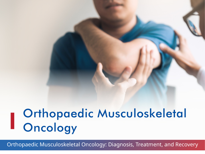 Orthopaedic / Musculoskeletal Oncology: Diagnosis, Treatment, and Recovery